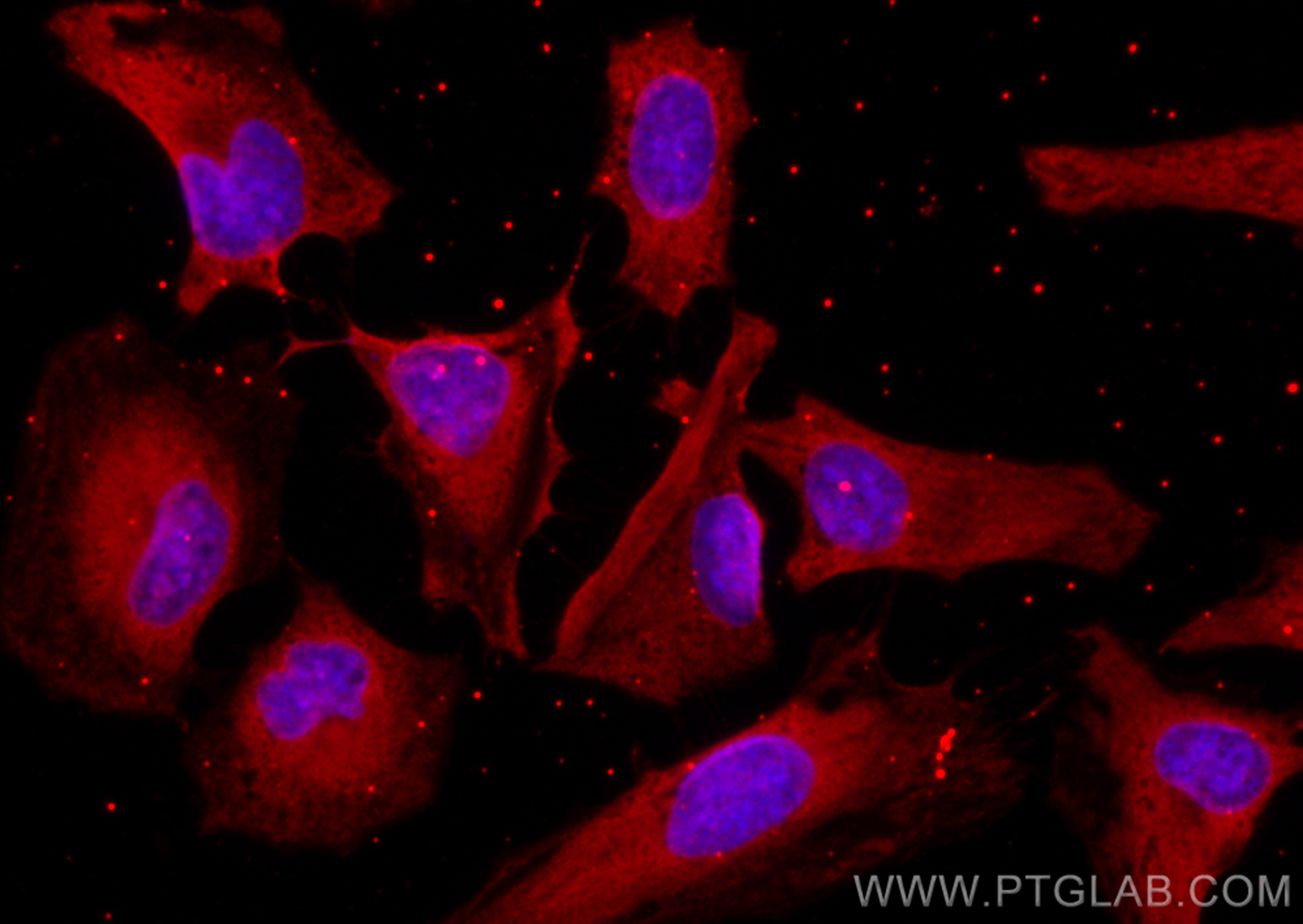 IF Staining of HeLa using CL594-68209