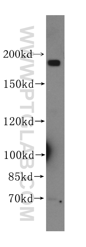 WB analysis of mouse brain using 17191-1-AP