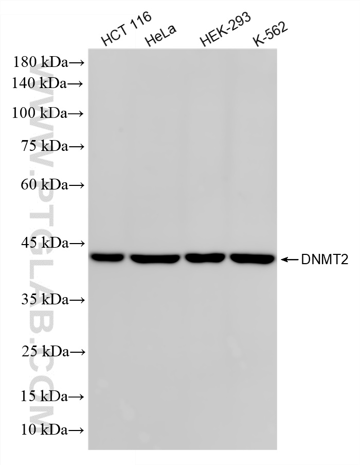 WB analysis using 87236-1-RR (same clone as 87236-1-PBS) WB analysis using 87236-1-RR (same clone as 87236-1-PBS)