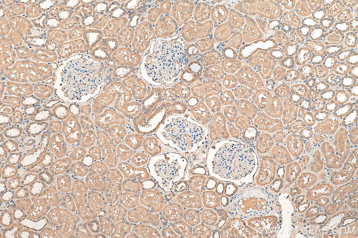 IHC staining of human kidney using 19366-1-AP