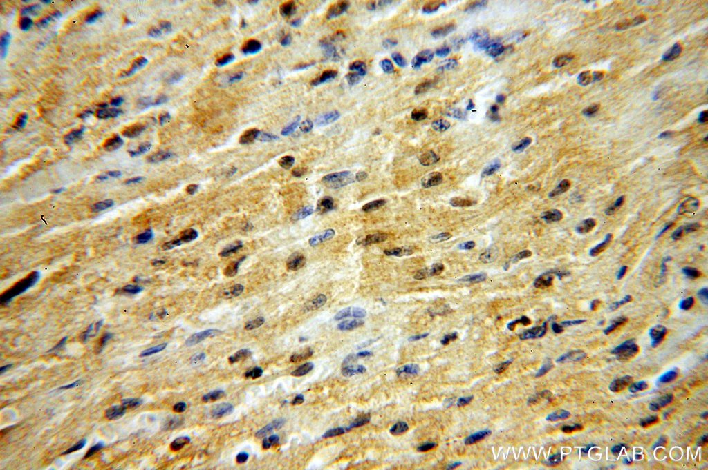 DNMT3A Polyclonal antibody