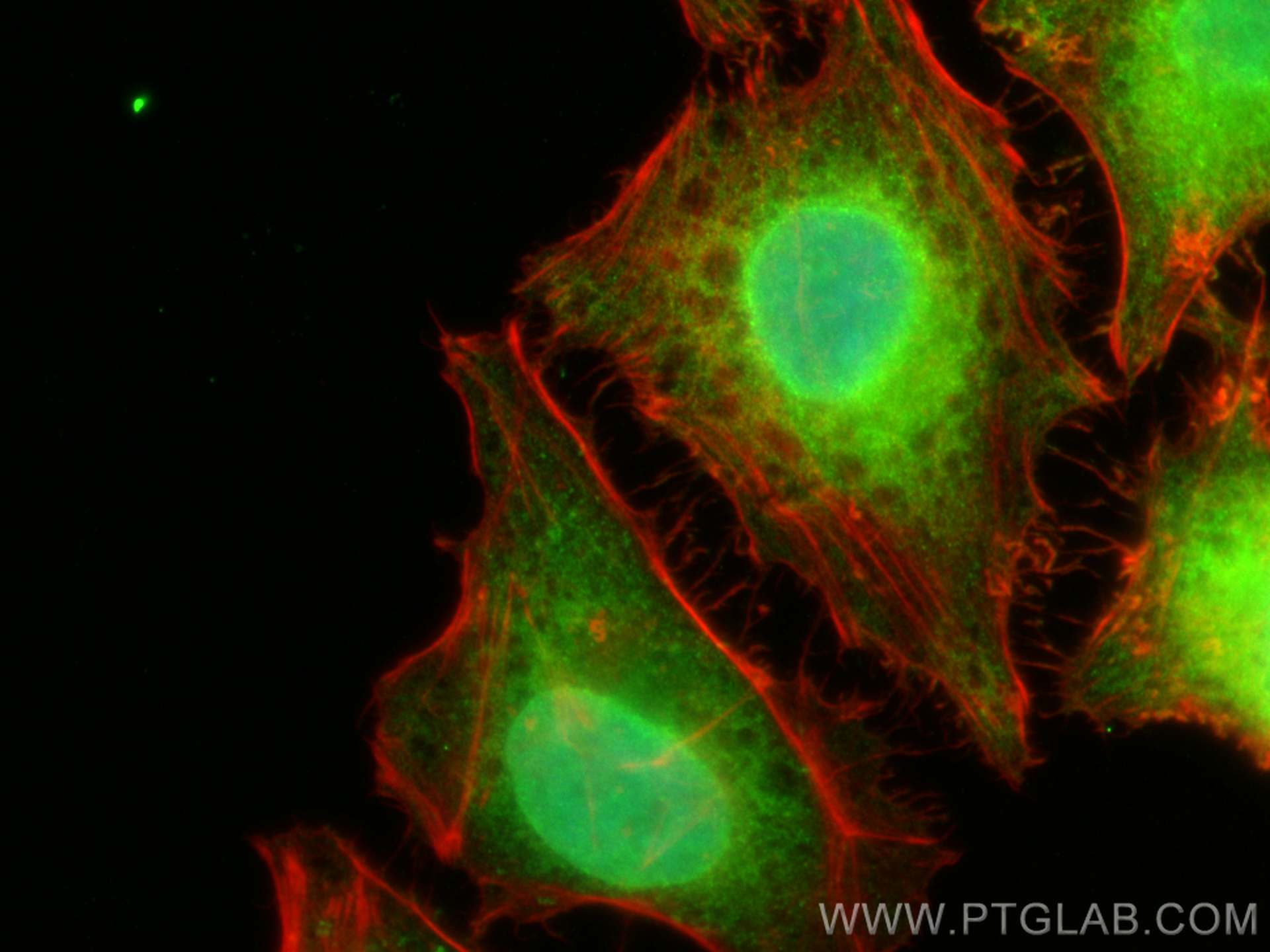 IF Staining of HeLa using 20954-1-AP