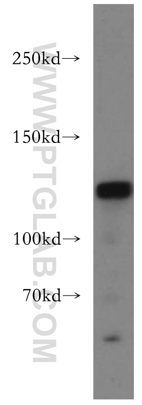 DNMT3A Polyclonal antibody