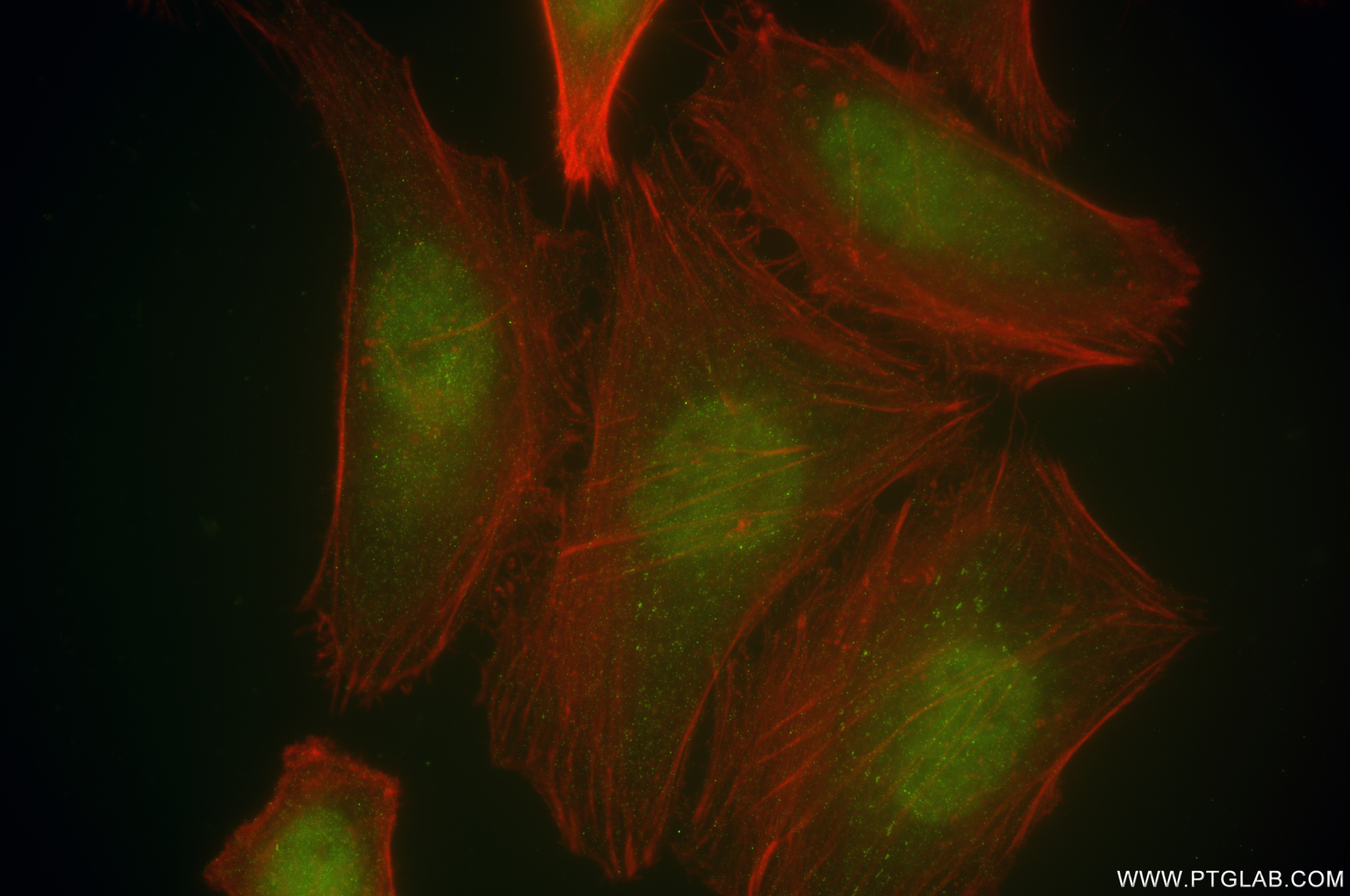 IF Staining of HeLa using 81474-6-PBS