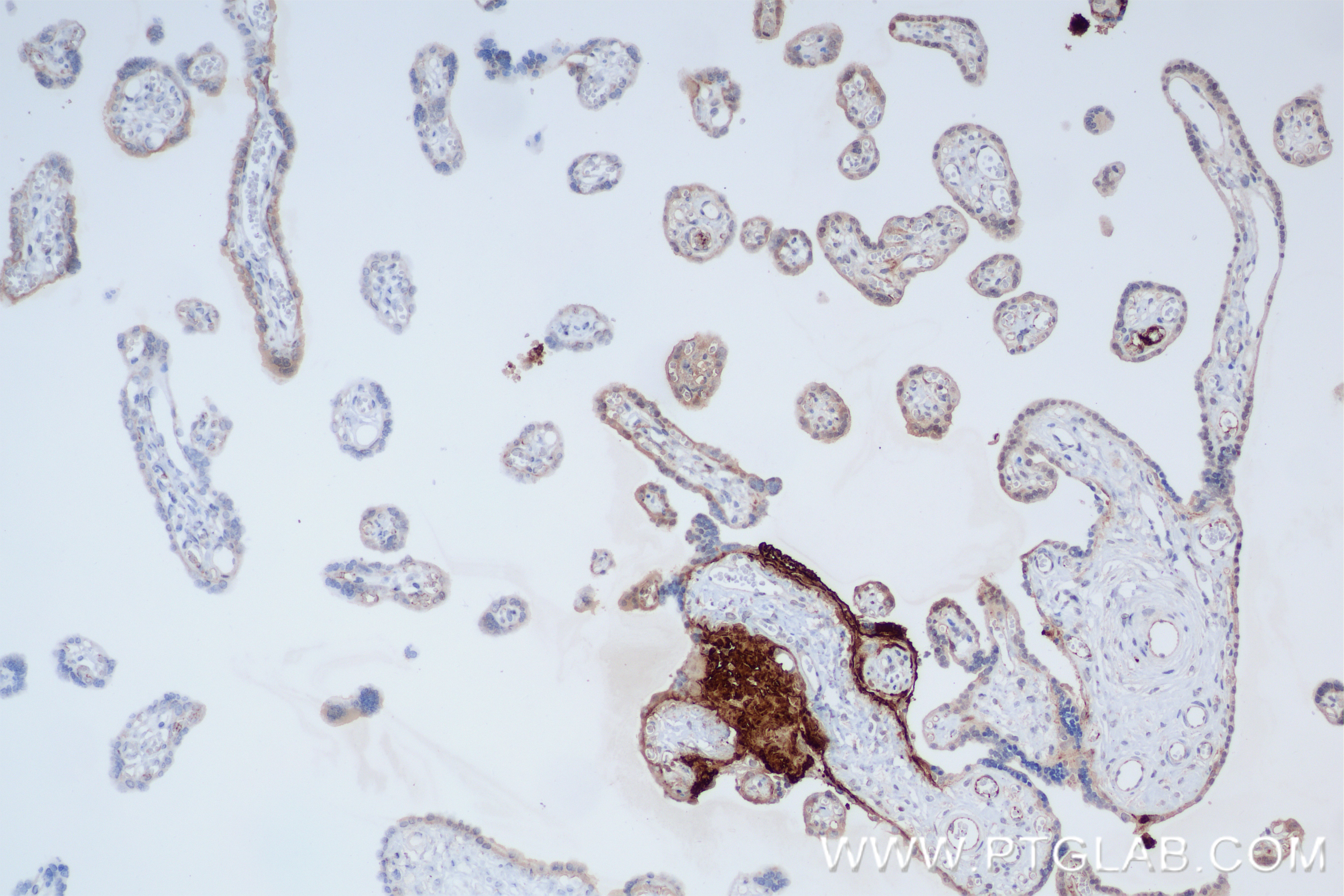 IHC staining of human placenta using 81474-6-RR