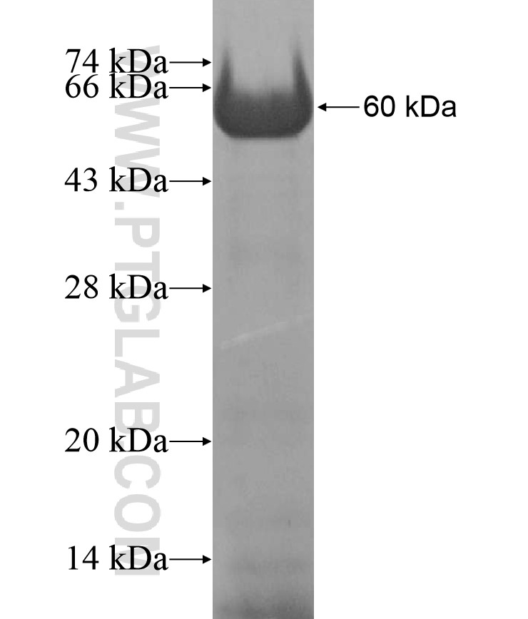 DNMT3A fusion protein Ag17117 SDS-PAGE DNMT3A fusion protein Ag17117 SDS-PAGE