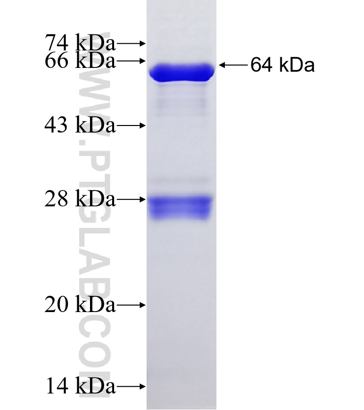 DNMT3A fusion protein Ag6271 SDS-PAGE DNMT3A fusion protein Ag6271 SDS-PAGE