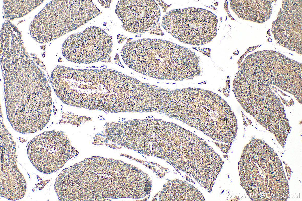 IHC staining of mouse testis using 15016-1-AP