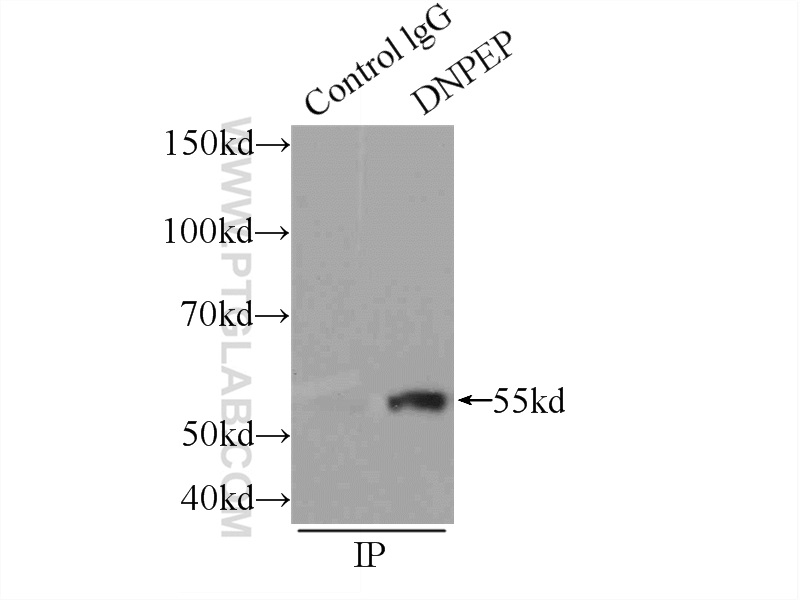 IP experiment of HEK-293 using 15016-1-AP