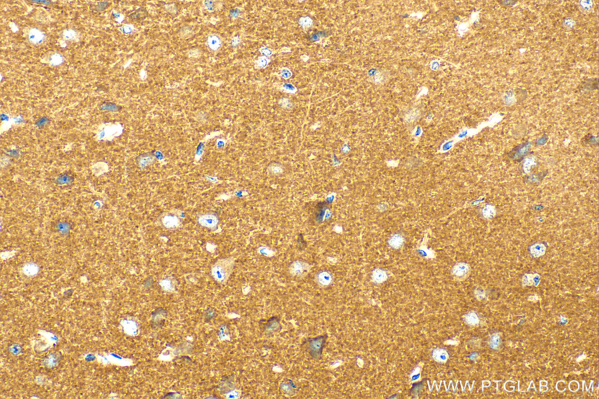 IHC staining of mouse brain using 20575-1-AP