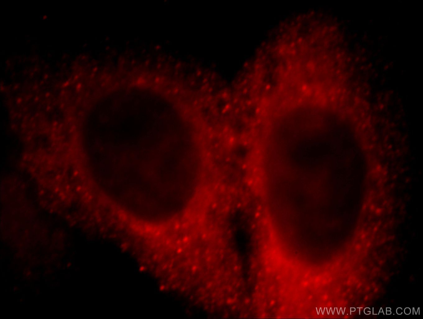 IF Staining of HepG2 using 20574-1-AP