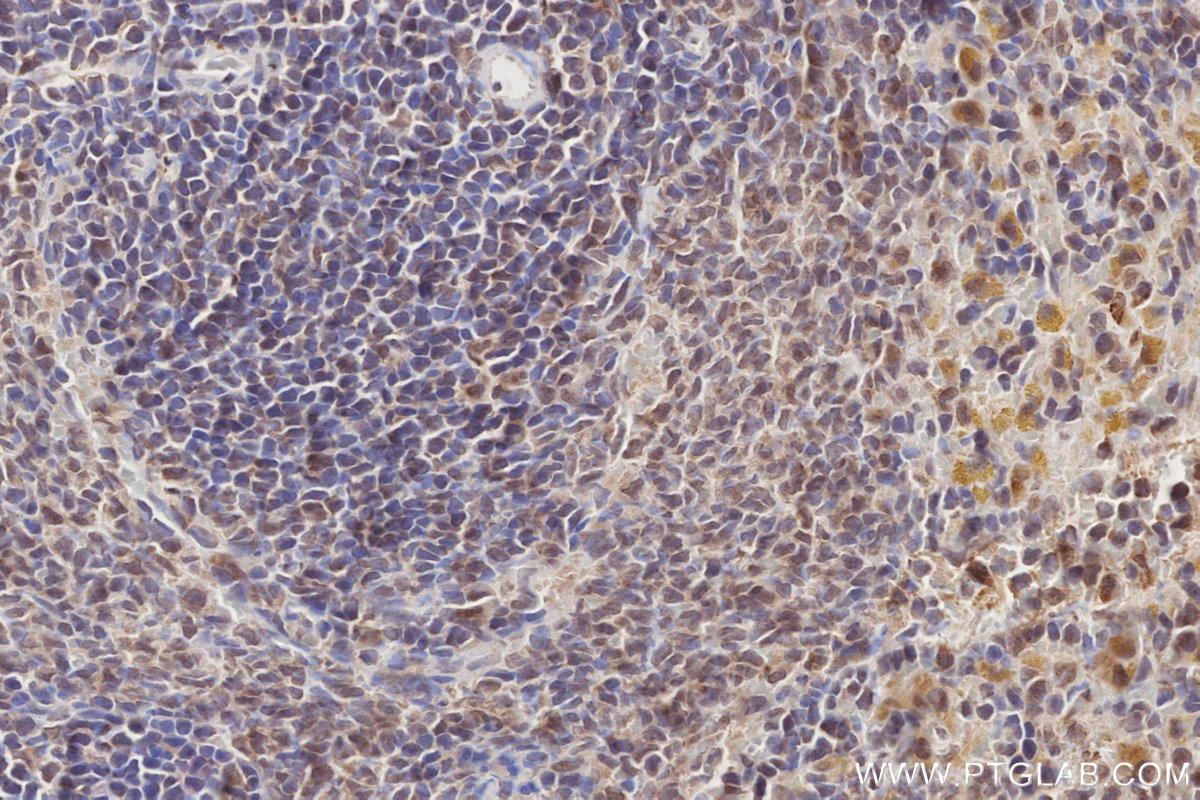 IHC staining of rat spleen using 16834-1-AP