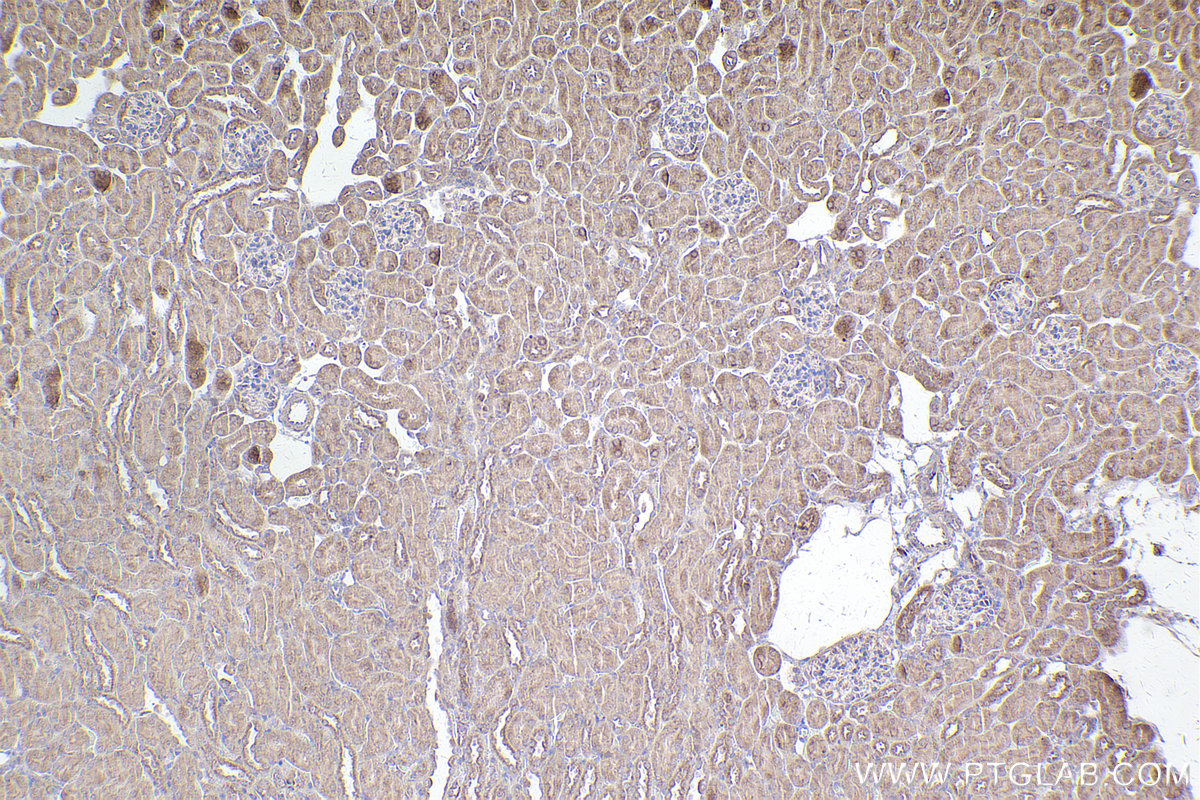IHC staining of mouse kidney using 31993-1-AP