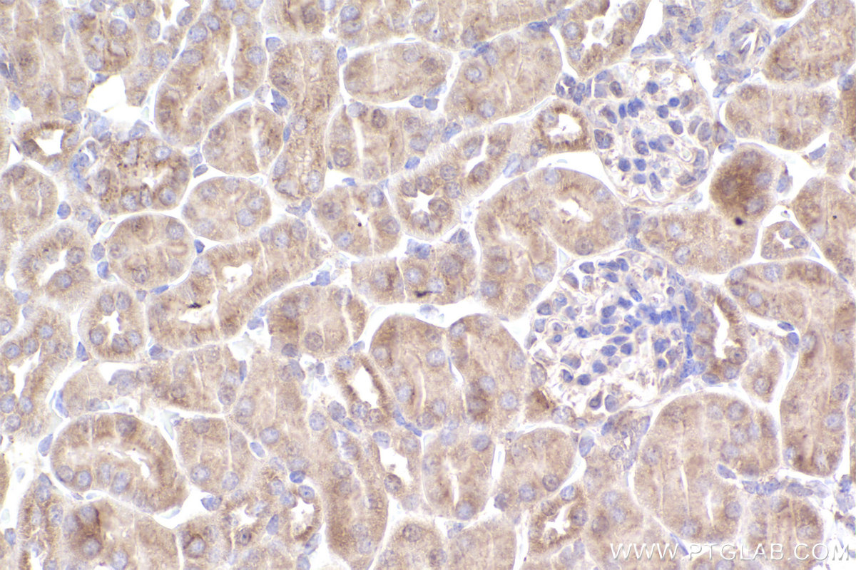 IHC staining of mouse kidney using 31993-1-AP