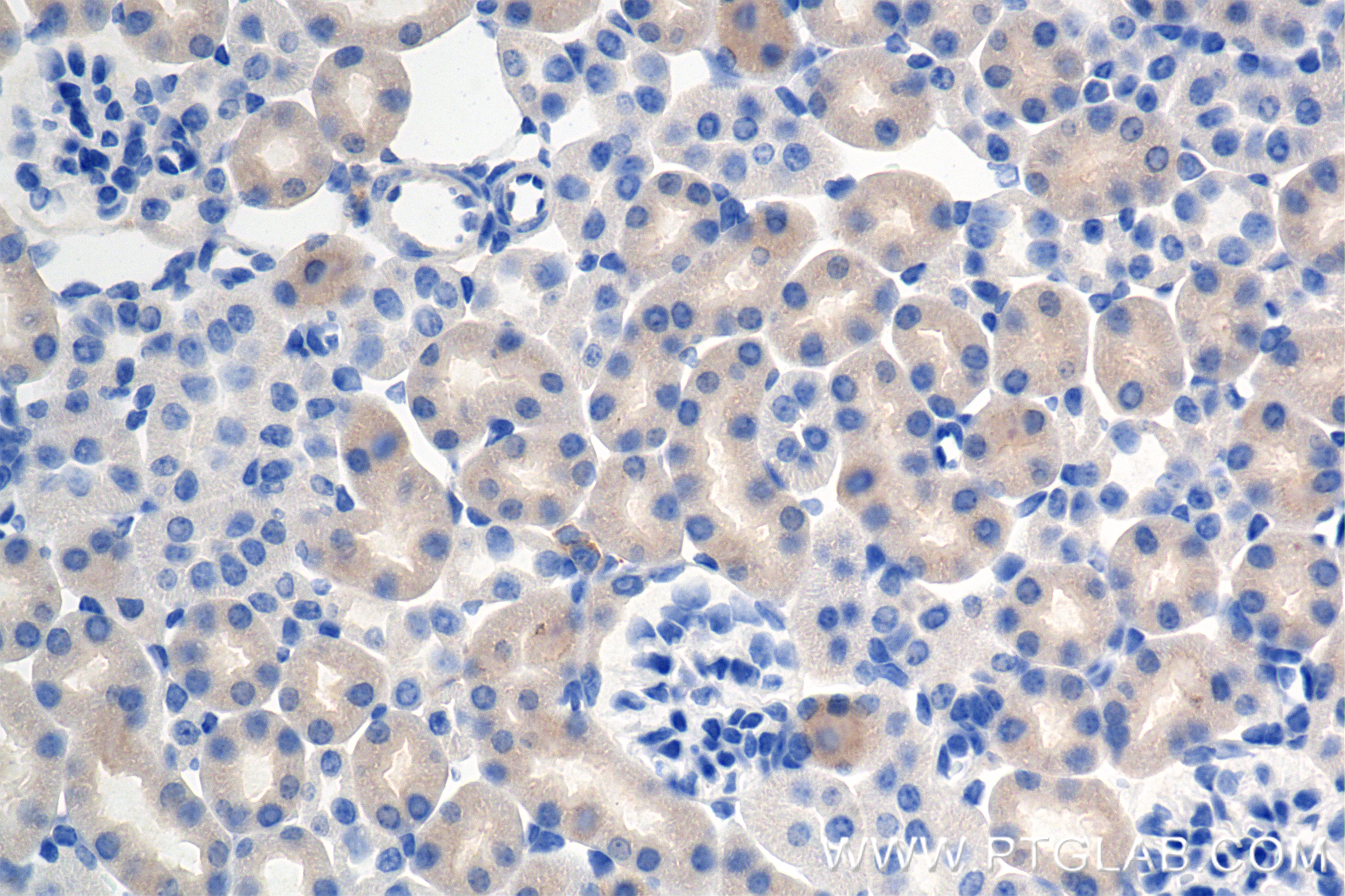Immunohistochemical analysis of paraffin-embedded mouse kidney tissue slide using <a class='green' href='/productredirect?CatalogNo=85022-3-RR' target='_blank'>85022-3-RR</a> (DOCK11 antibody) at dilution of 1:500 (under 40x lens). Heat mediated antigen retrieval with Tris-EDTA buffer (pH 9.0). This data was developed using the same antibody clone with 85022-3-PBS in a different storage buffer formulation. IHC staining of mouse kidney using 85022-3-RR (same clone as 85022-3-PBS)
