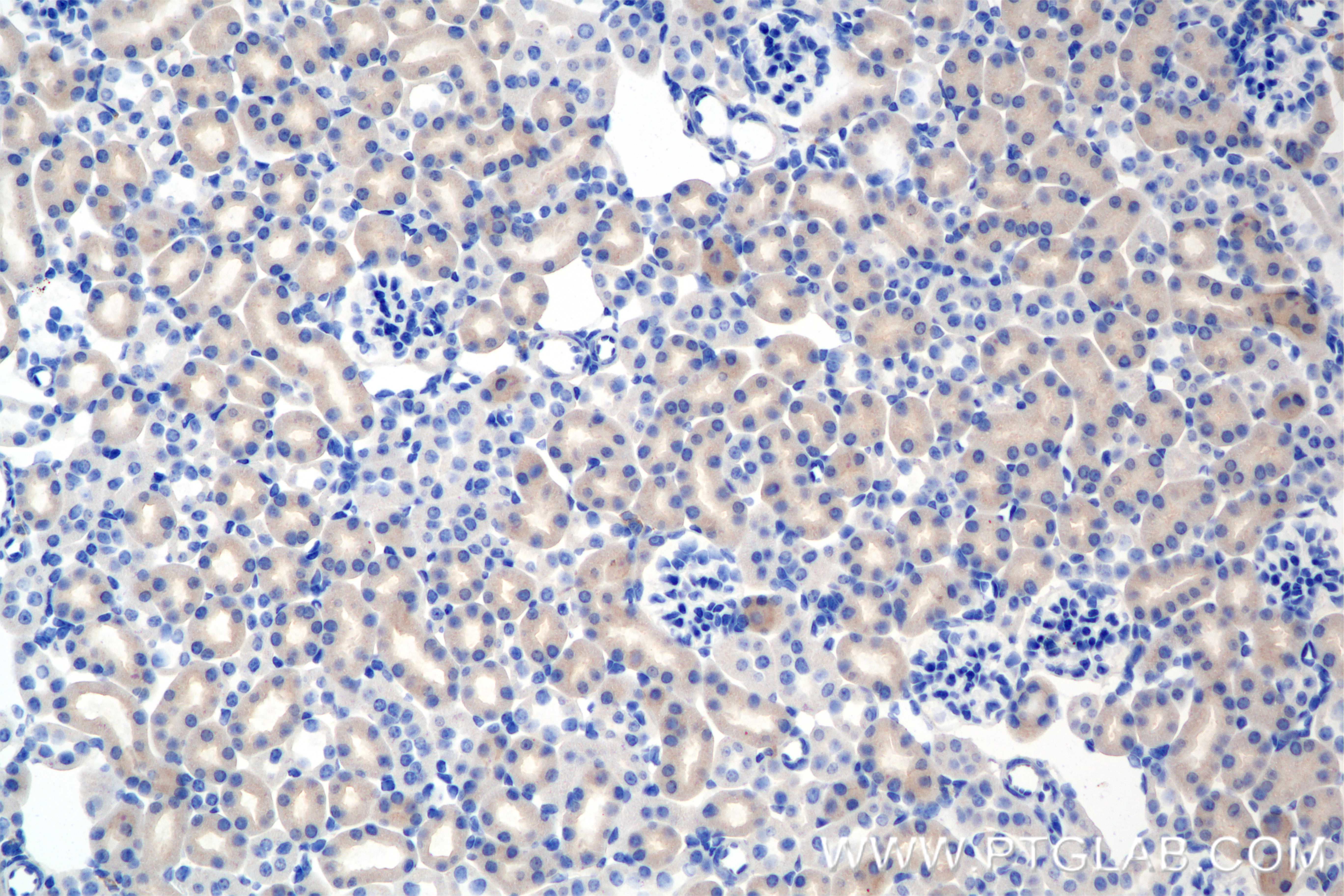 Immunohistochemical analysis of paraffin-embedded mouse kidney tissue slide using <a class='green' href='/productredirect?CatalogNo=85022-3-RR' target='_blank'>85022-3-RR</a> (DOCK11 antibody) at dilution of 1:500 (under 20x lens). Heat mediated antigen retrieval with Tris-EDTA buffer (pH 9.0). This data was developed using the same antibody clone with 85022-3-PBS in a different storage buffer formulation. IHC staining of mouse kidney using 85022-3-RR (same clone as 85022-3-PBS)