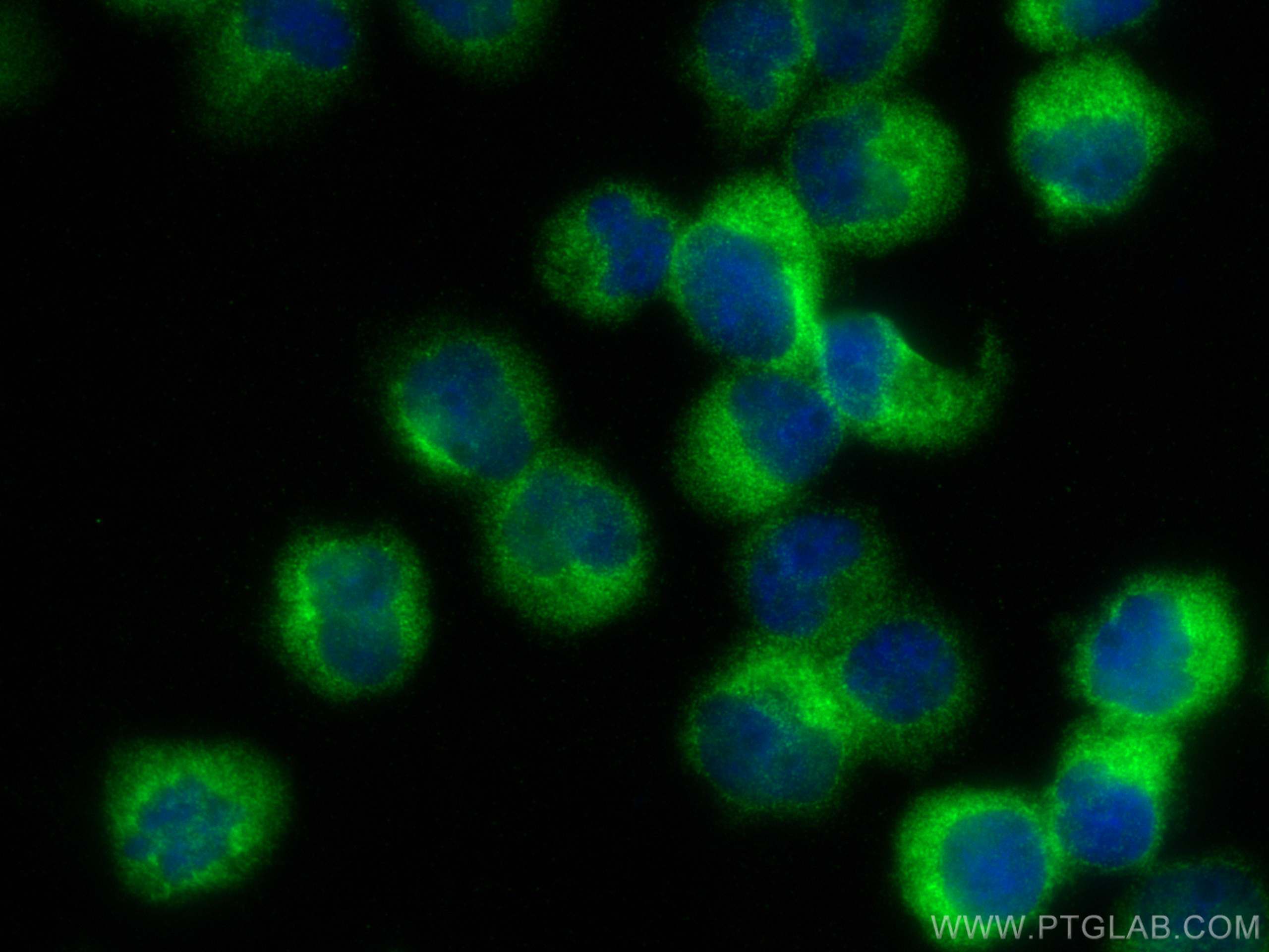 IF Staining of Jurkat using 20245-1-AP