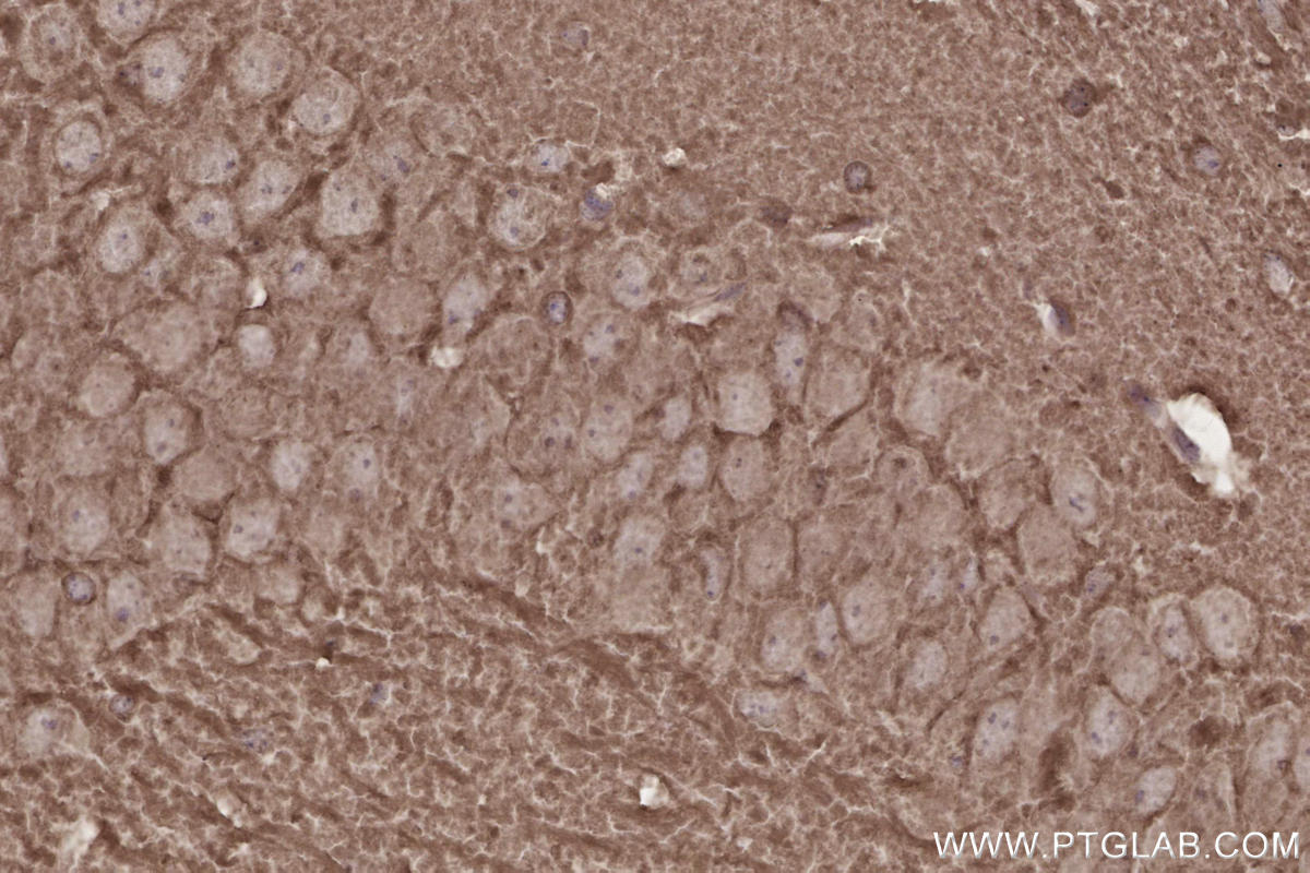 IHC staining of mouse brain using 20683-1-AP IHC staining of mouse brain using 20683-1-AP