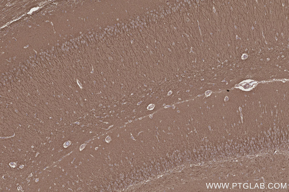 IHC staining of rat brain using 20683-1-AP IHC staining of rat brain using 20683-1-AP