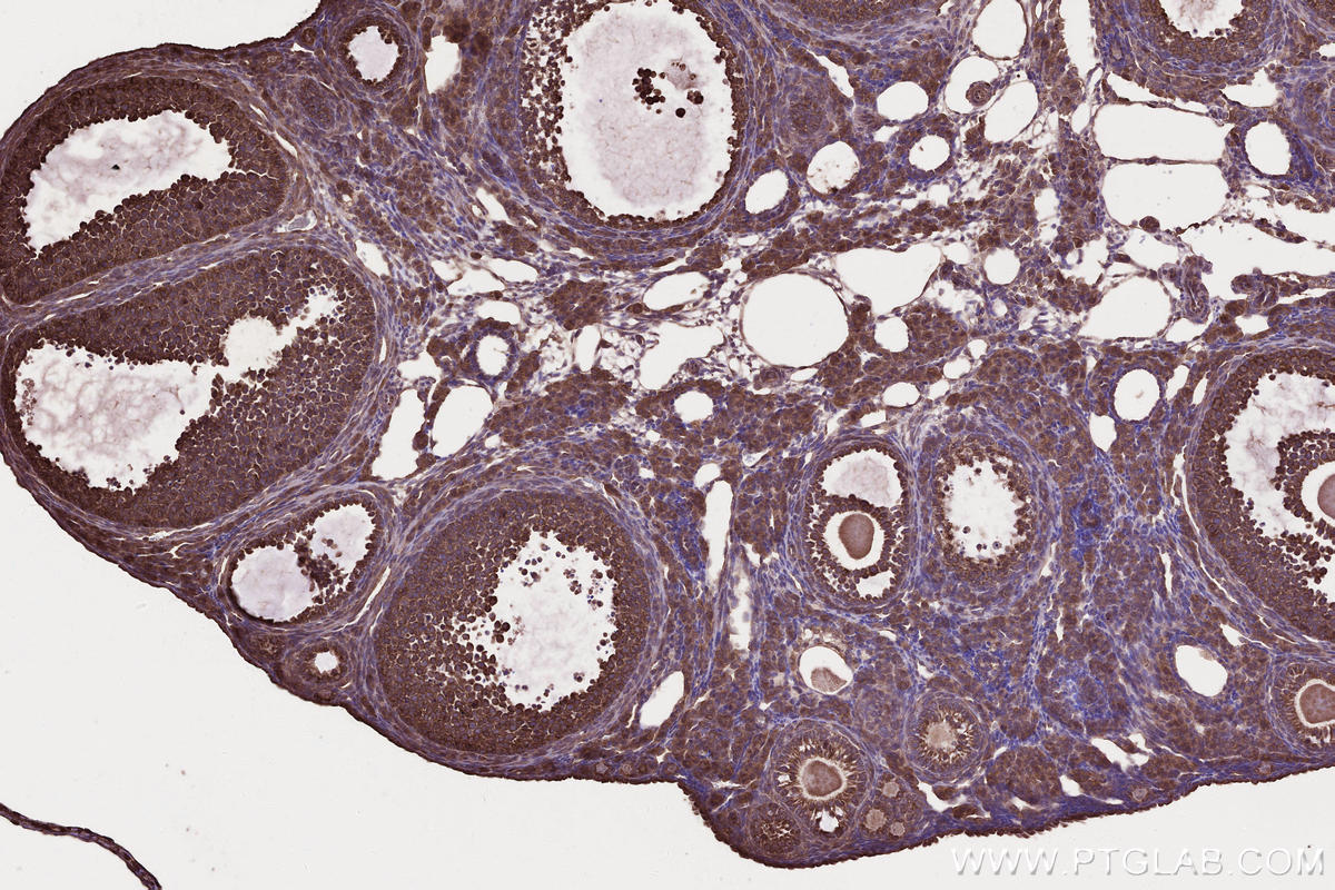 IHC staining of mouse ovary using 21861-1-AP IHC staining of mouse ovary using 21861-1-AP