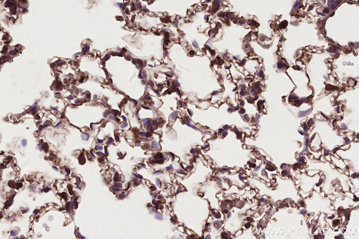 IHC staining of rat lung using 21861-1-AP IHC staining of rat lung using 21861-1-AP