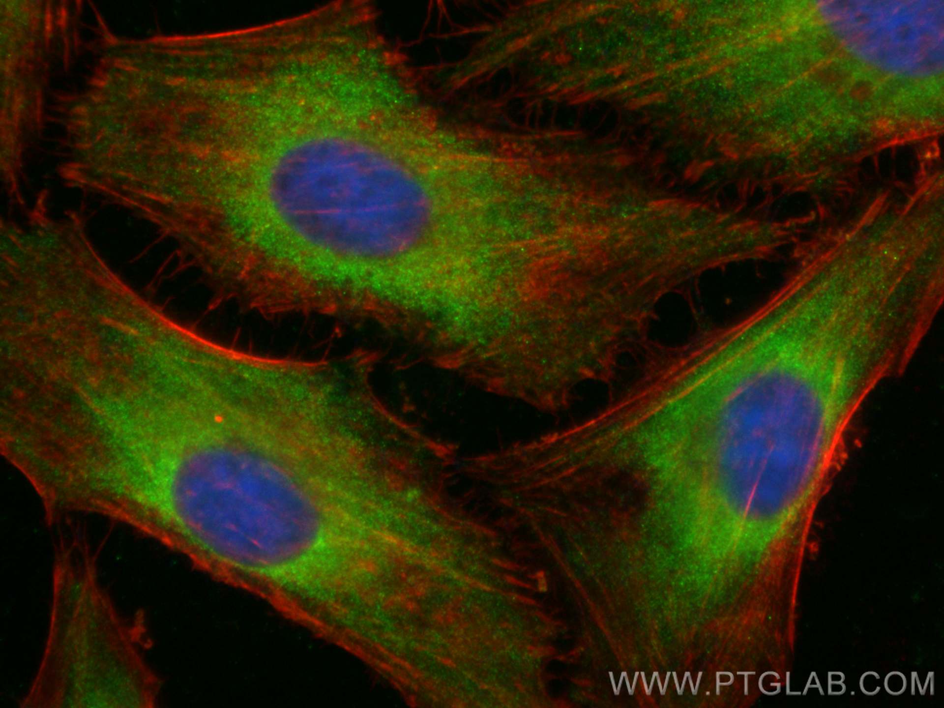 IF Staining of HeLa using CL488-27151