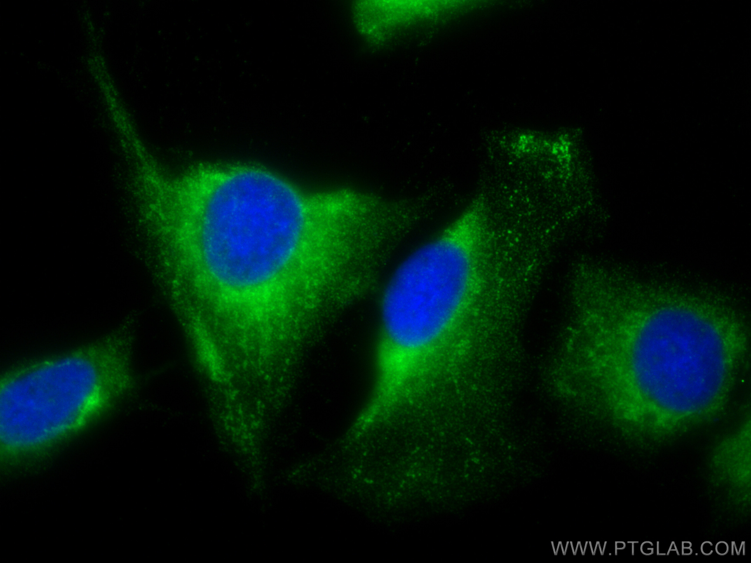 IF Staining of U2OS using 29938-1-AP