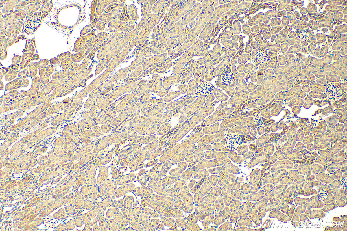 IHC staining of mouse kidney using 29938-1-AP