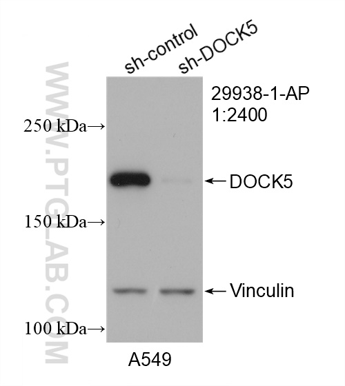 WB analysis of A549 using 29938-1-AP