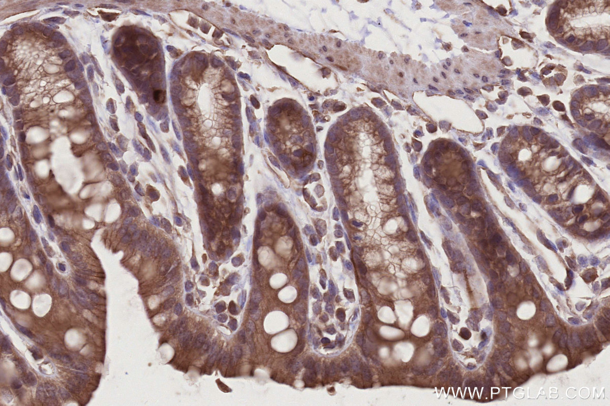 IHC staining of mouse colon using 25087-1-AP IHC staining of mouse colon using 25087-1-AP