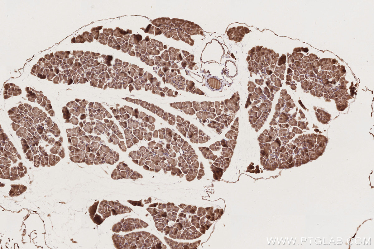IHC staining of mouse pancreas using 25087-1-AP