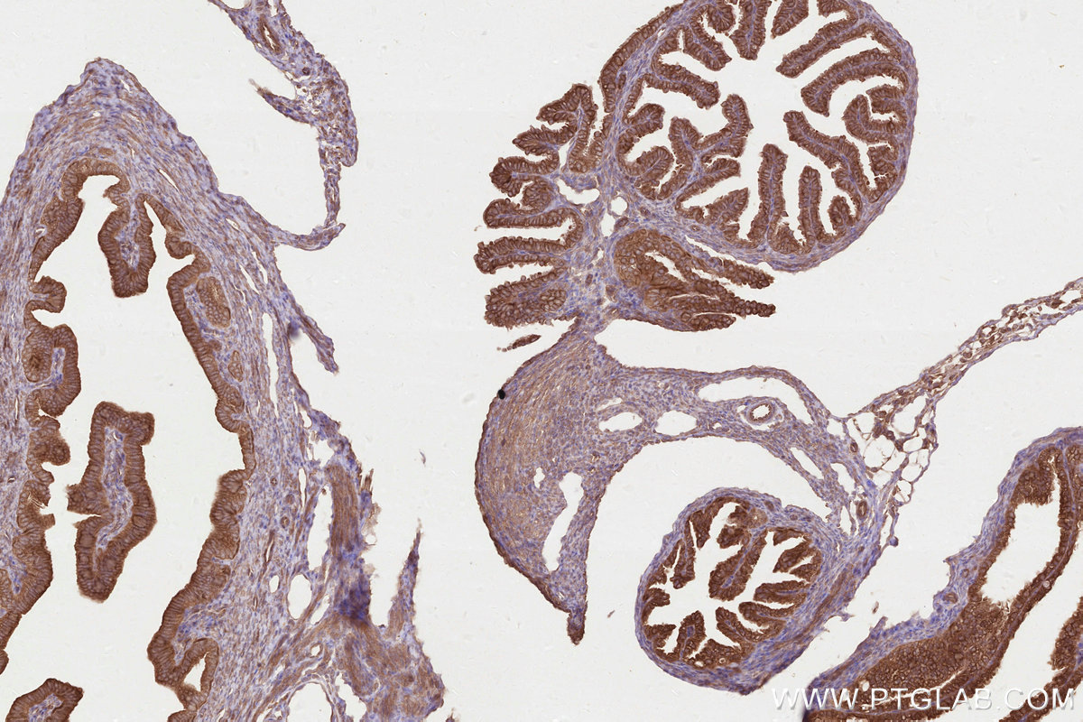 IHC staining of mouse ovary using 13000-1-AP IHC staining of mouse ovary using 13000-1-AP