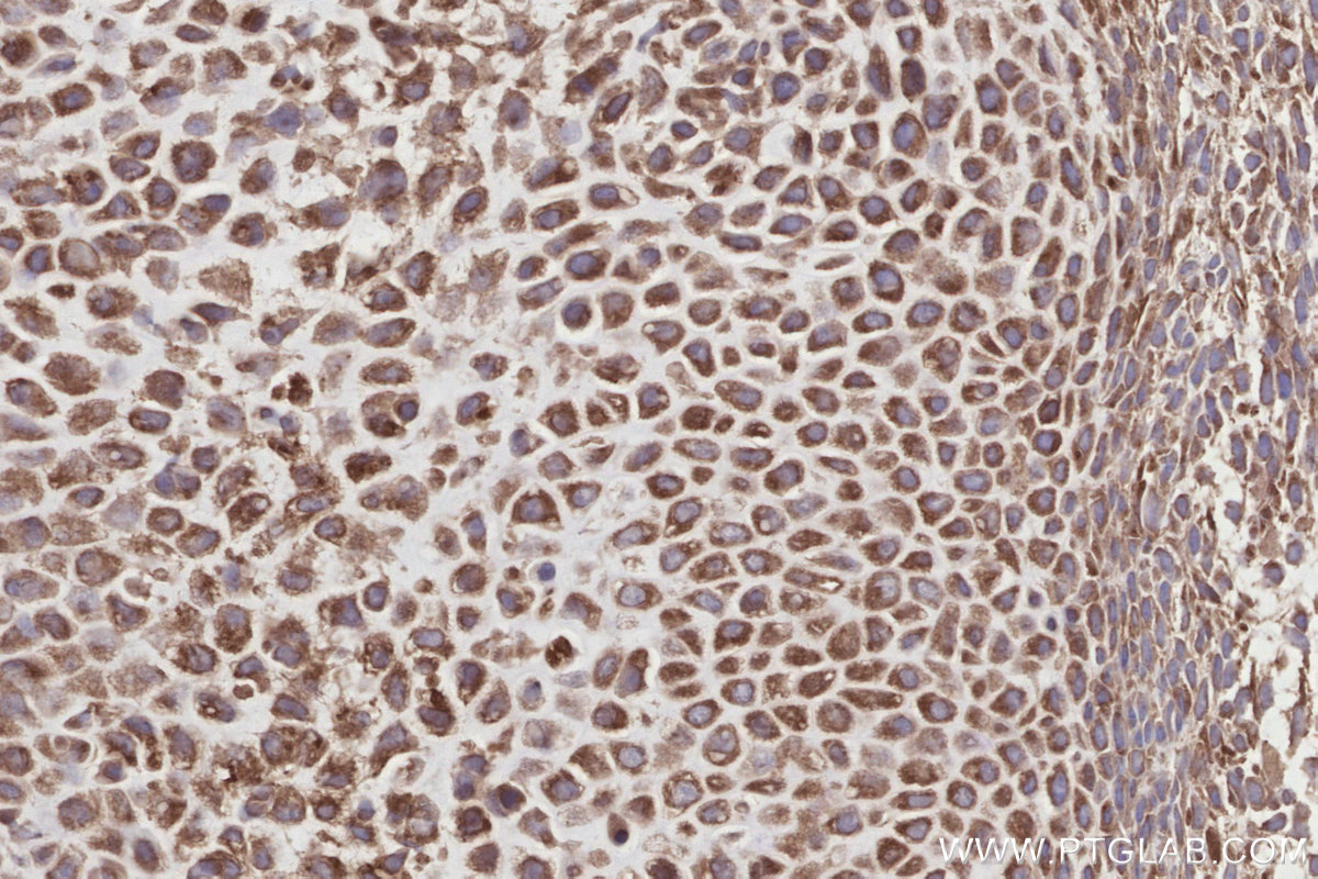 IHC staining of mouse embryo using 13000-1-AP IHC staining of mouse embryo using 13000-1-AP