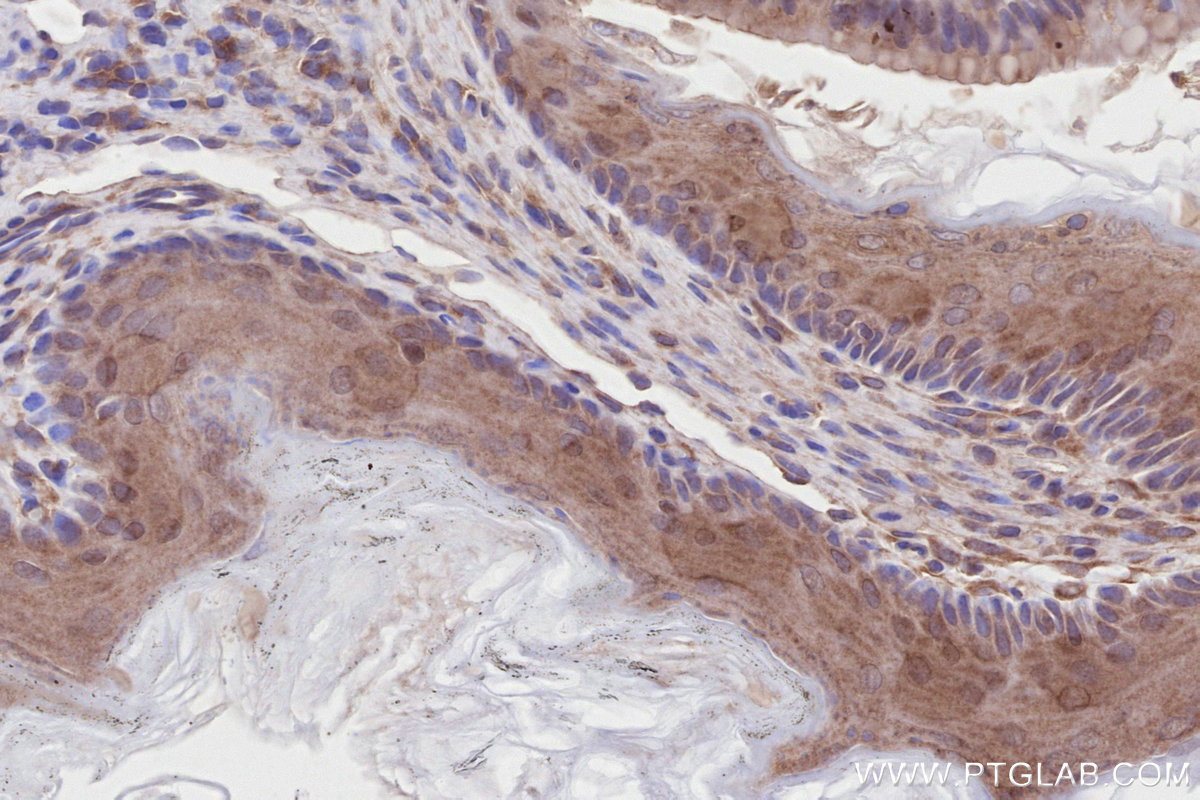 IHC staining of mouse stomach using 13000-1-AP IHC staining of mouse stomach using 13000-1-AP