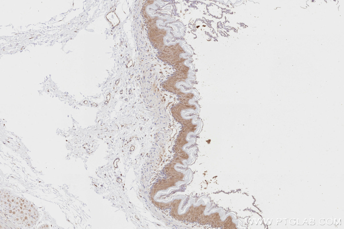IHC staining of rat stomach using 13000-1-AP IHC staining of rat stomach using 13000-1-AP