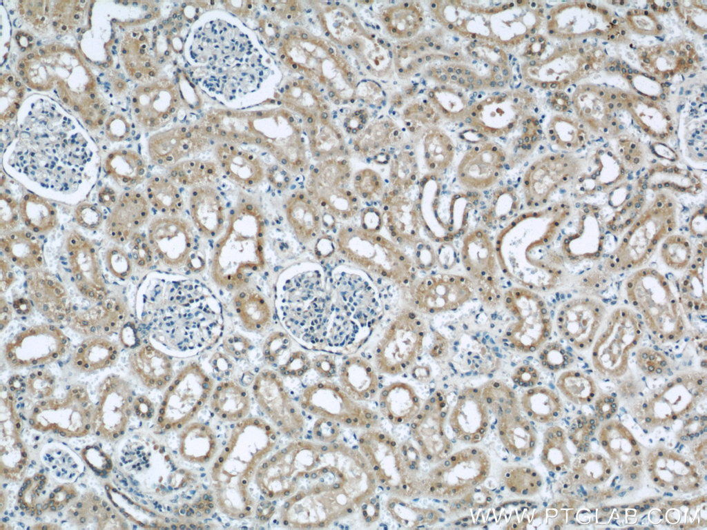 IHC staining of human kidney using 11622-1-AP