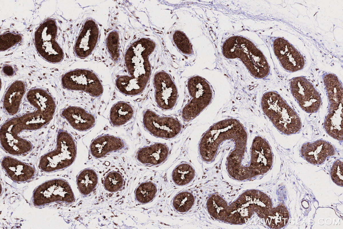 IHC staining of rat epididymis using 83270-2-RR