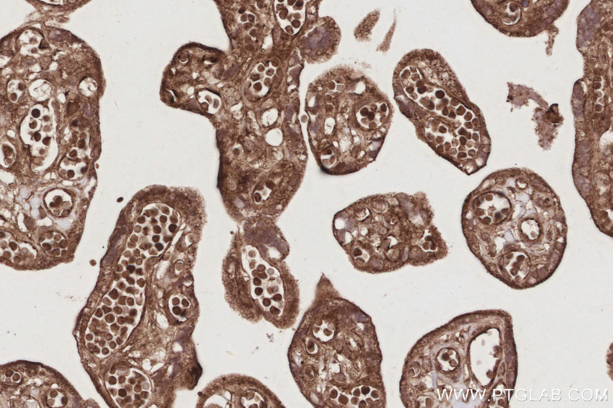 IHC staining of human placenta using 18987-1-AP IHC staining of human placenta using 18987-1-AP