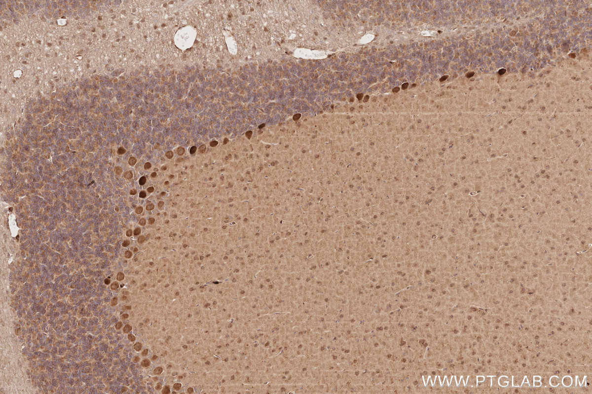 IHC staining of rat cerebellum using 18987-1-AP IHC staining of rat cerebellum using 18987-1-AP