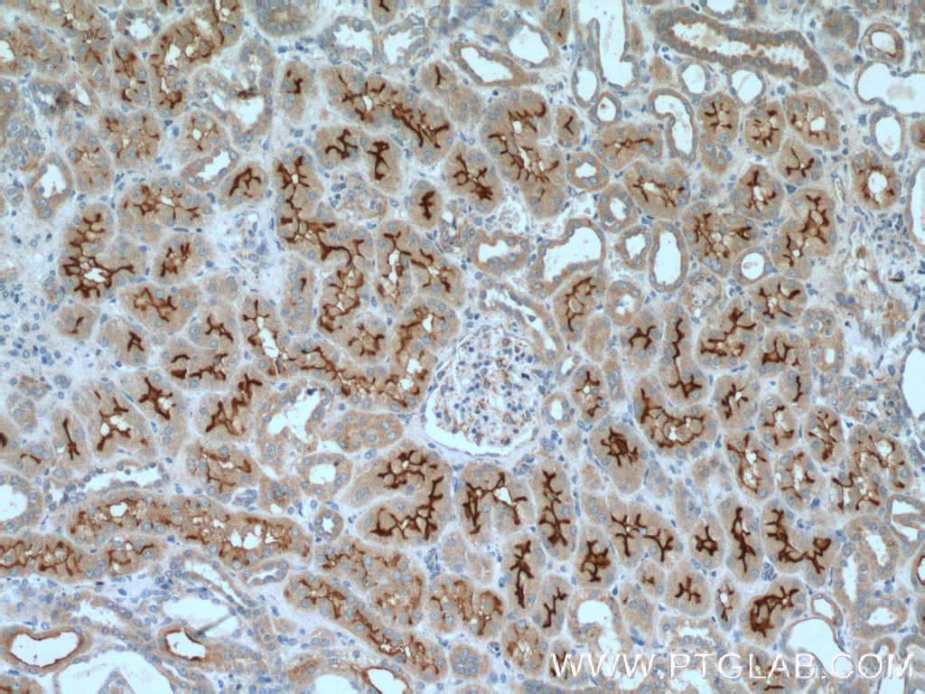 IHC staining of human kidney using 18987-1-AP