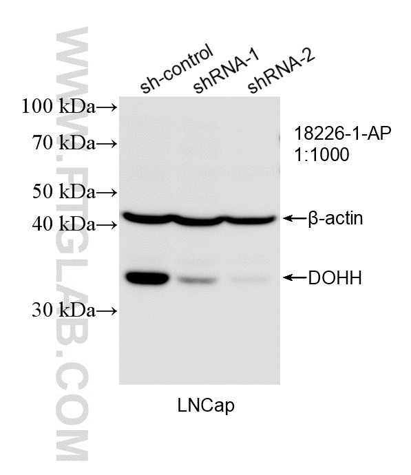 WB analysis of LNCaP using 18226-1-AP