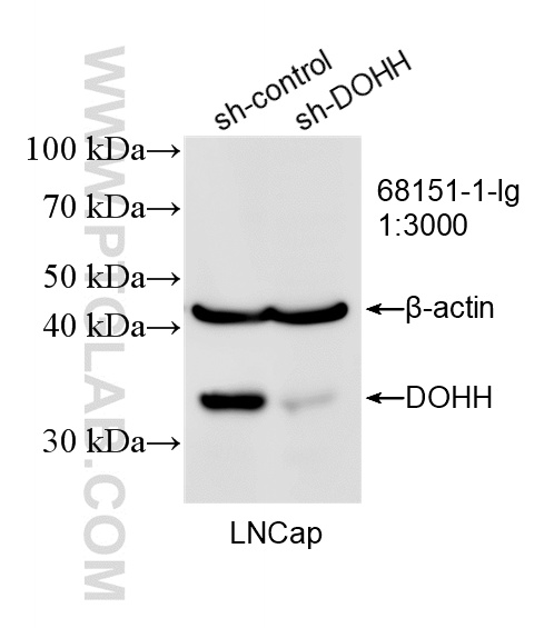 WB analysis of LNCaP using 68151-1-Ig