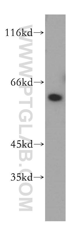 WB analysis of K-562 using 17822-1-AP