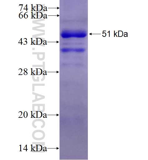 DOK2 fusion protein Ag5356 SDS-PAGE DOK2 fusion protein Ag5356 SDS-PAGE
