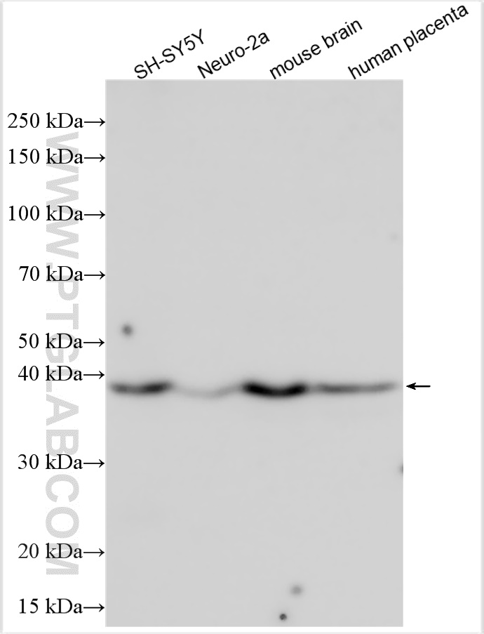 WB analysis using 14108-1-AP