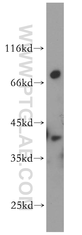 WB analysis of mouse brain using 14108-1-AP