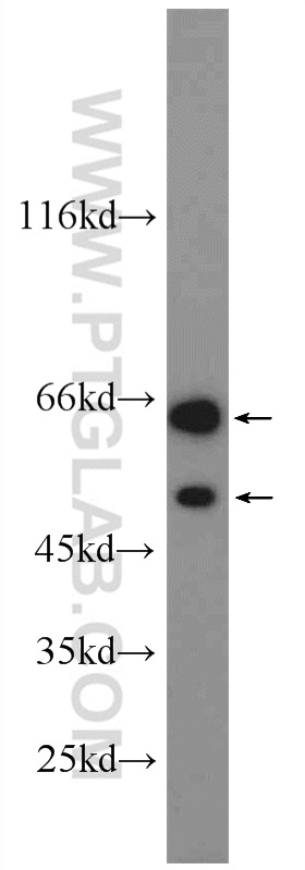 WB analysis of HEK-293 using 22697-1-AP