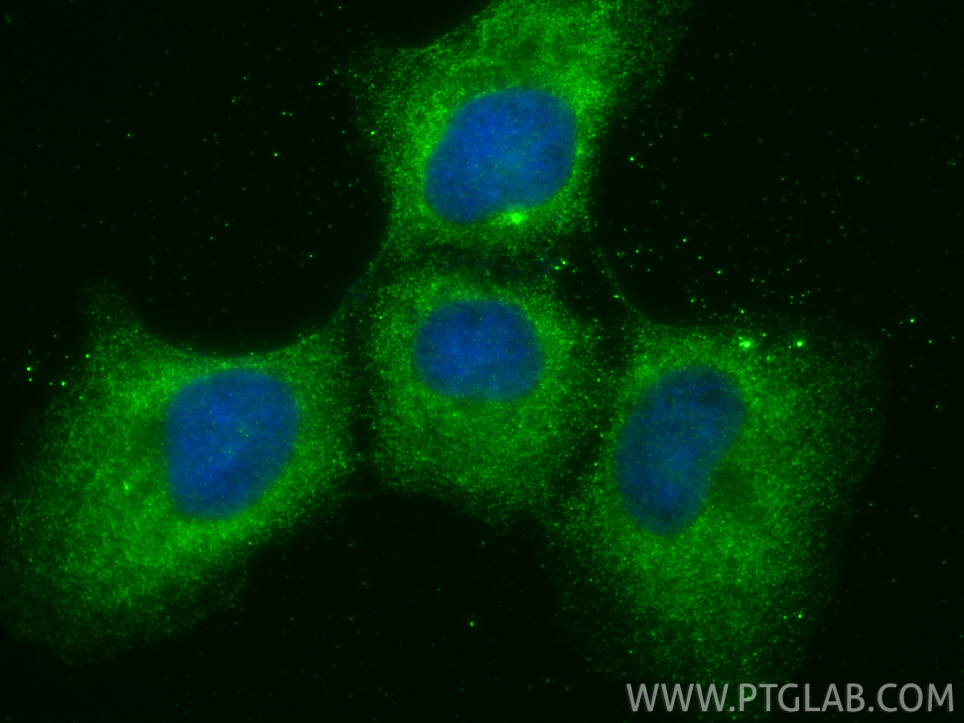 IF Staining of A431 using 34200-1-AP IF Staining of A431 using 34200-1-AP