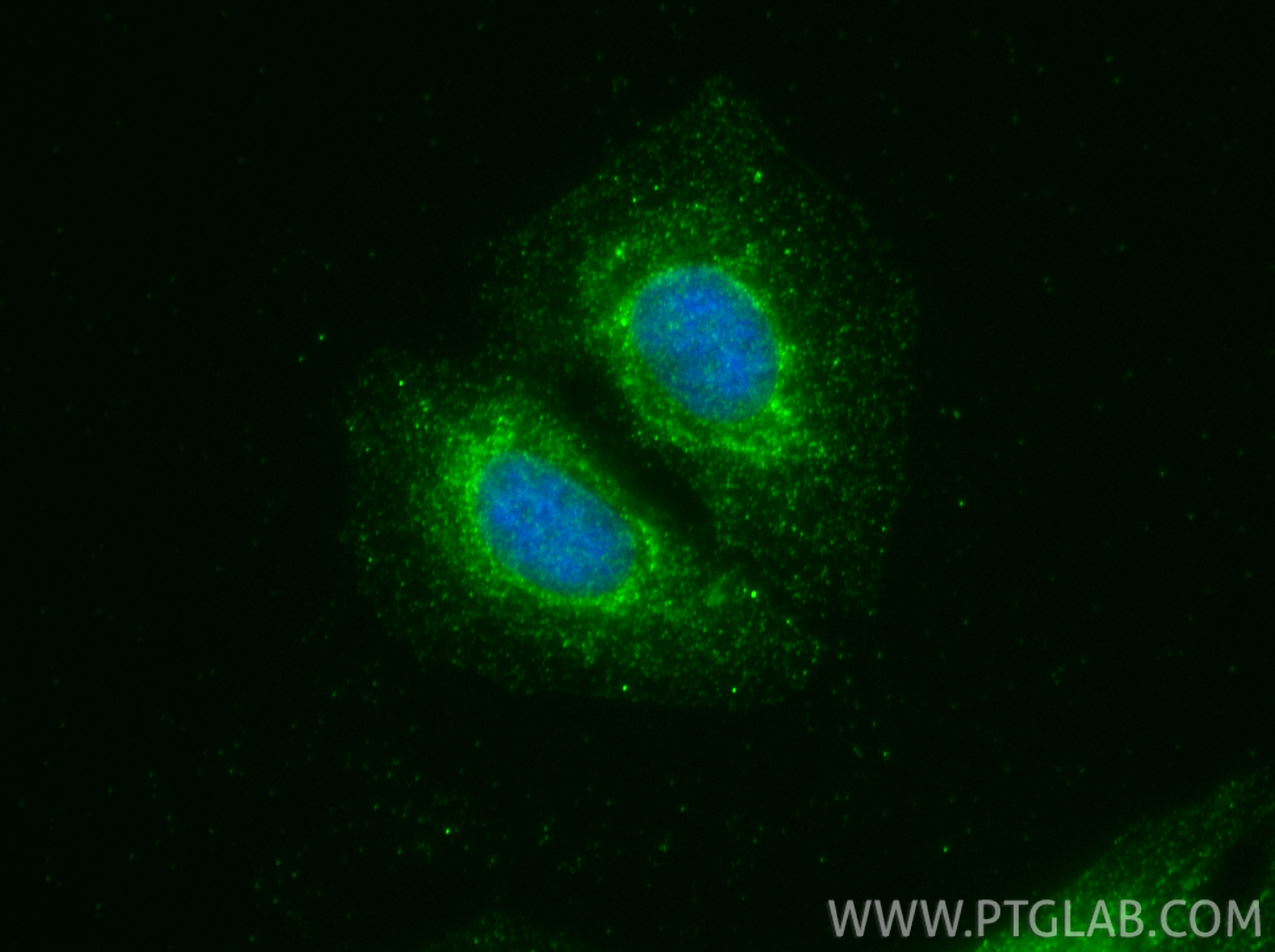 IF Staining of U2OS using 34200-1-AP IF Staining of U2OS using 34200-1-AP