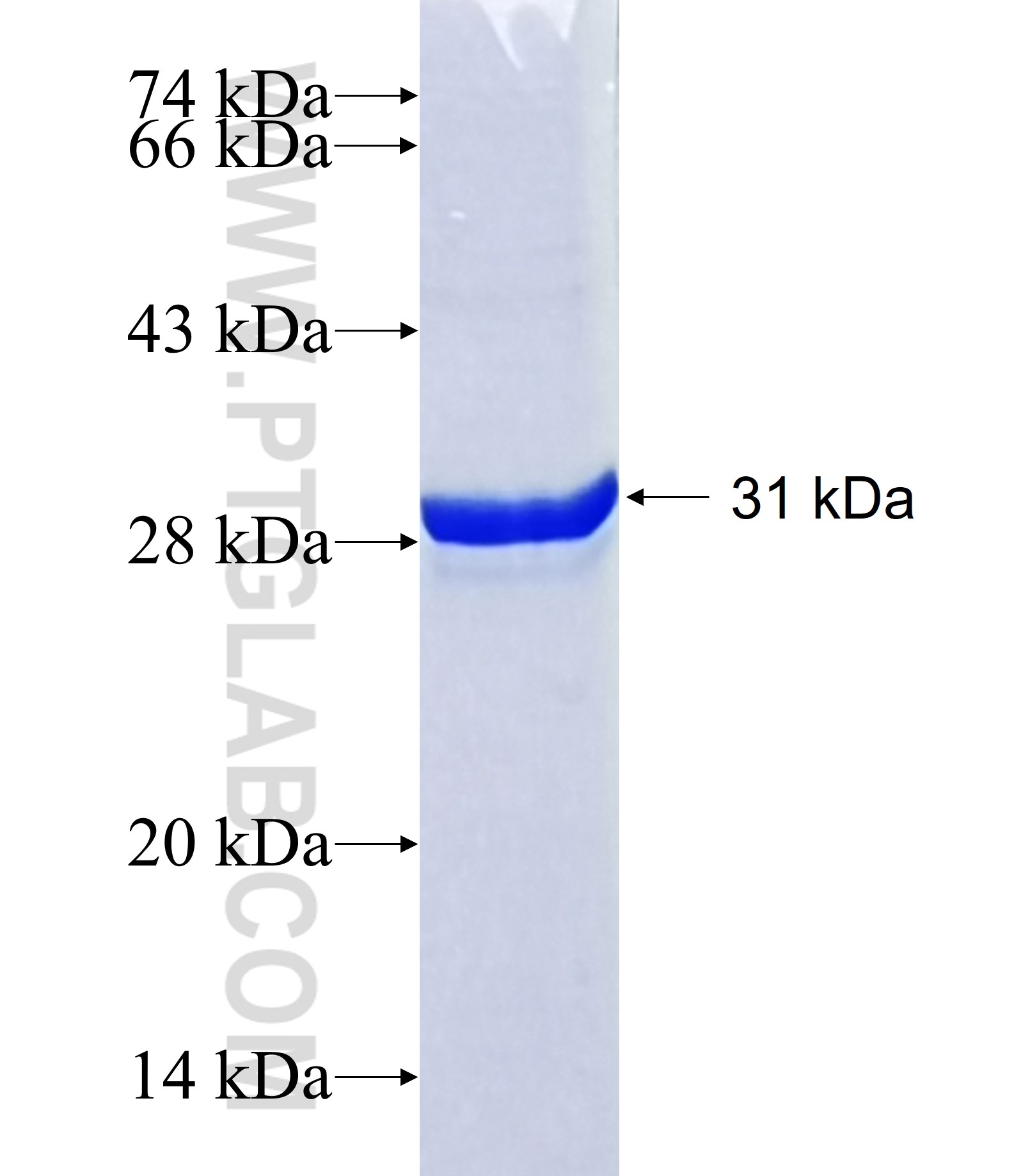 DOLPP1 fusion protein Ag40783 SDS-PAGE DOLPP1 fusion protein Ag40783 SDS-PAGE